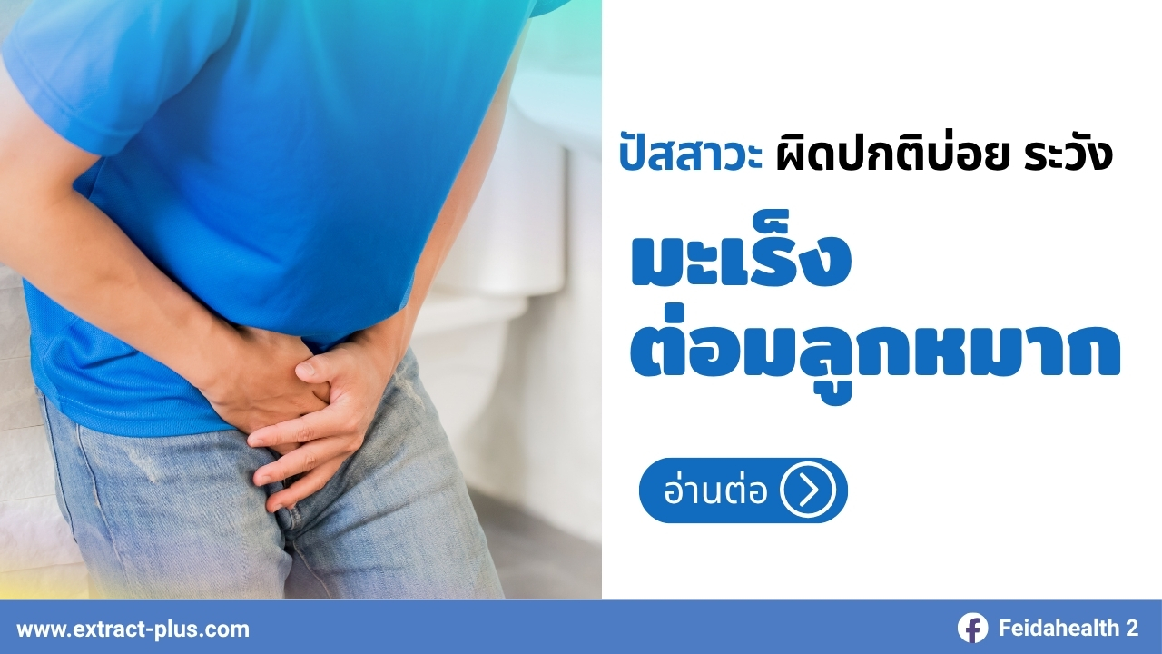 ปัสสาวะผิดปกติบ่อย ระวังมะเร็งต่อมลูกหมาก